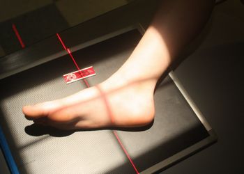 Is It Broken or Fractured?  